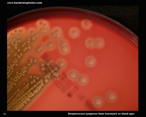beta hemolysis on blood agar